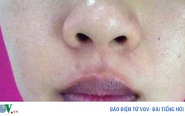 Đôi môi nói gì về sức khỏe của bạn?