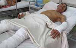 Nửa đêm cháu mua xăng đốt bỏng nhà cậu