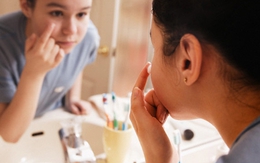 Nhận biết sức khỏe qua nếp nhăn trên mặt