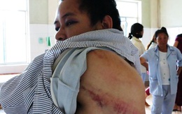 Lời kể của gia đình cán bộ ngân hàng bị hành hung, bắt cóc