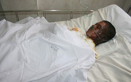 Say rượu, tưới 5 lít xăng thiêu sống bạn