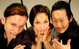 Kinh dị kiểu làm đẹp bằng cách "bóp méo" trán 