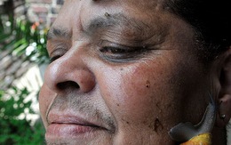 Kinh dị với kiểu làm đẹp từ ốc sên