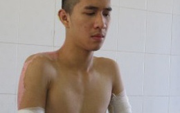 Bênh bạn, bị bơm xăng đốt sau kỳ thi tốt nghiệp