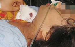 Từ chối tình yêu, một thiếu nữ bị đâm thủng cổ