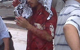 Hà Nội: Chém người dã man gần cây xăng Lương Yên