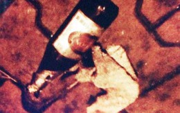 Ném bom xăng khiến cháu ruột bị bỏng nặng