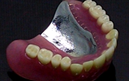 Cướp ngân hàng quốc gia để lấy tiền làm răng