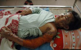 Người mẹ tưới xăng châm lửa đốt con lĩnh án