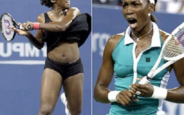 "No mắt" với những bộ thời trang "gây sốc" của nữ VĐV