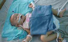 Điểm tin sáng: Cháu bé bị cha ném dập não tại Kon Tum đã hồi phục sức khỏe