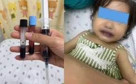 1 giờ sau khi ăn canh nấu bằng nước giếng, bé gái tím tái toàn thân, máu chuyển thành màu đen