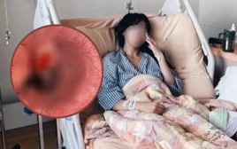 Cô gái Kiên Giang 26 tuổi từ vong chỉ sau 12 giờ phát hiện ung thư dạ dày, đâu là những biểu hiện sớm?