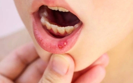 4 dấu hiệu răng miệng cảnh báo ung thư đang đến gần