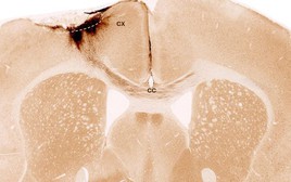 Tìm ra phương pháp mới hứa hẹn “đảo ngược” đột quỵ