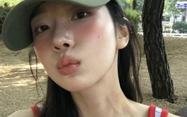 3 thứ màu đỏ "kỳ lạ" trên cơ thể thật ra là dấu hiệu ung thư cực ít người để ý