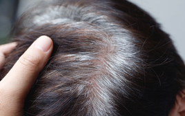 Bác sĩ nói gì về tin “tóc bạc nhiều là dấu hiệu ung thư”?