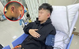 Hà Nội: Bé trai 12 tuổi nghi bị bố của bạn tát, đánh đến choáng váng, hé lộ nguồn cơn