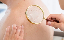 Đi khám da, bàng hoàng phát hiện nhiễm HIV: Tất cả chỉ vì 1 sai lầm của nhiều năm trước