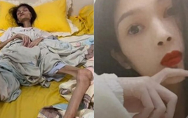 Nữ Tiktoker 27 tuổi qua đời vì chứng teo dạ dày, lúc cuối đời chỉ còn 17,5 kg: Mọi chuyện bắt đầu từ hoàn cảnh gia đình