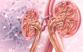 6 cách đào thải axit uric tự nhiên nhưng không phải ai cũng biết: Hỗ trợ phòng gout và bảo vệ thận