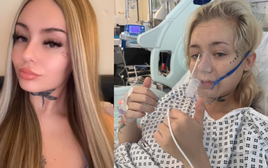 Cô gái 21 tuổi bị ung thư phổi sau 6 năm duy trì 1 sở thích vạn người trẻ mê