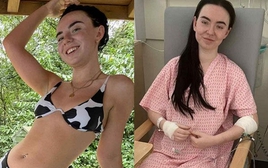 "Bác sĩ nói tôi chỉ còn 48 giờ để sống" - Cô gái 25 tuổi không ngờ mình suýt mất mạng vì bỏ qua những dấu hiệu tưởng bình thường