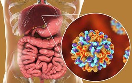 4 bệnh tưởng chừng lành tính nhưng có thể là tiền thân của ung thư