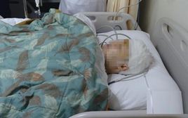 Người phụ nữ 55 tuổi viêm màng não sau khi ăn loại thịt nhà nào cũng có trong tủ lạnh