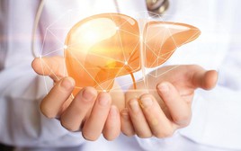 Sự thật bất ngờ về thanh lọc, giải độc gan