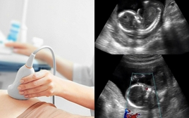 Thai phụ mất con sau khi bị buộc về quê làm cỗ: Câu chuyện khiến cộng đồng xót xa và cảnh báo nguy cơ cho mẹ bầu