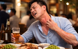 Uống vài ngụm rượu đã nổi mề đay, khó thở: Dấu hiệu dị ứng đe dọa tính mạng