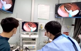 Sán dây dài gần 1 mét sống trong đại tràng người đàn ông có thói quen ăn đồ tái