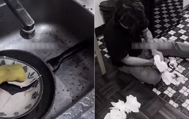 Rửa bát, tay người đàn ông chảy máu xối xả, phải khâu 4 mũi: Bác sĩ cảnh báo thói quen nhiều người mắc