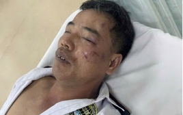 Truy tìm nhóm thanh niên nẹt pô, đánh bảo vệ gãy xương sườn