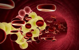 7 dấu hiệu của người có mỡ máu cao: Sau 40 tuổi nếu không có thì xin chúc mừng!