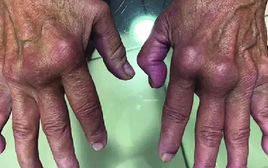 Nóng: Loại virus “phá hủy nội tạng” có thể chuẩn bị bùng phát