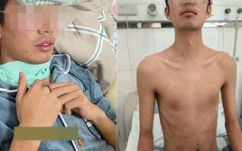 25 tuổi phát hiện ung thư gan giai đoạn cuối, bác sĩ xót xa: 3 sai lầm đang âm thầm “hủy hoại” lá gan nhiều người mắc phải