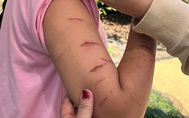 Chủ tịch UBND tỉnh Cà Màu chỉ đạo khẩn vụ nữ sinh lớp 5 bị gây thương tích