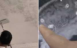 Bé gái 6 tuổi bị "đục" 20 lỗ ở não, suýt thành người thực vật: 5 góc khuất chứa đầy “chất độc vô hình” phải cẩn trọng khi dọn dẹp nhà đón Tết