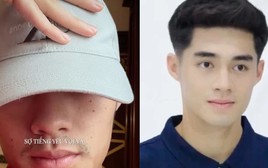 Tình hình của thủ môn Trung Kiên