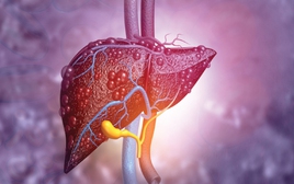 Có 1 dấu hiệu kéo dài suốt 3 tháng, người đàn ông đi khám phát hiện gan “dày đặc khối u”