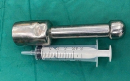 Thiếu niên 15 tuổi mắc kẹt chày kim loại dài 18 cm ở trực tràng