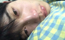 Bác sĩ nhắc nhở 6 triệu chứng phổ biến nhất của ung thư ruột: Tiếc là rất nhiều người bỏ qua, tưởng là… "ốm vặt"