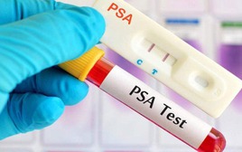 3 ca ung thư tuyến tiền liệt trong 1 ngày, bác sĩ chỉ lý do bệnh dễ bị bỏ sót