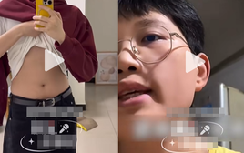 Nam thanh niên 32 tuổi mới "dậy thì", phát triển ngực như phụ nữ, bác sĩ sốc khi nồng độ hormone nam chỉ dưới 0.1