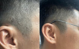 Xu hướng chăm sóc da đầu mới: Không chỉ sạch gàu mà còn phải “sạch bền vững”