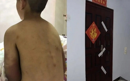 Bi kịch của cậu bé 14 tuổi vẫn phải mặc tã