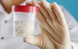 Đàn ông thời nay chăm gym, ăn sạch nhưng… tinh trùng yếu: BS y học giới tính nói đây là những thói quen nên từ bỏ