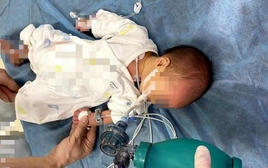 Em bé 52 ngày tuổi ngộ độc Botulinum nguy kịch vì loại nước chữa ho, bổ phổi rất quen từ bà ngoại